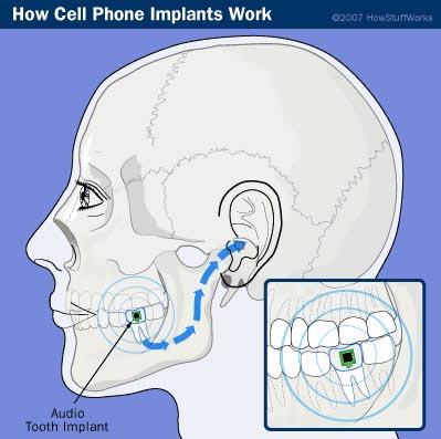 ���˽ڿ�����ʮ��ȥ��(��ͼ)(2)